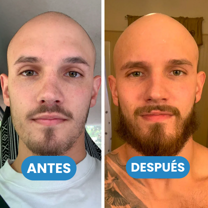 Sovana Jumbo Beard - Aceite estimulante para crecimiento de barba