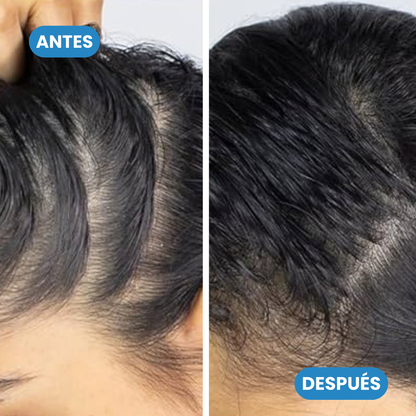 Sovana BodyWise - Sérum Roll-On para la defensa contra tus entradas