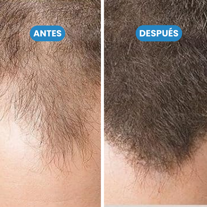 Sanorys Botana - Champú de Crecimiento Capilar con Aceite de Botana