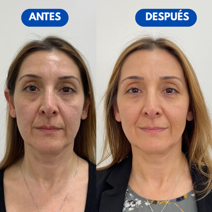 Sovana Peter Thomas™ - Crema tensora instantánea para bolsas y ojeras