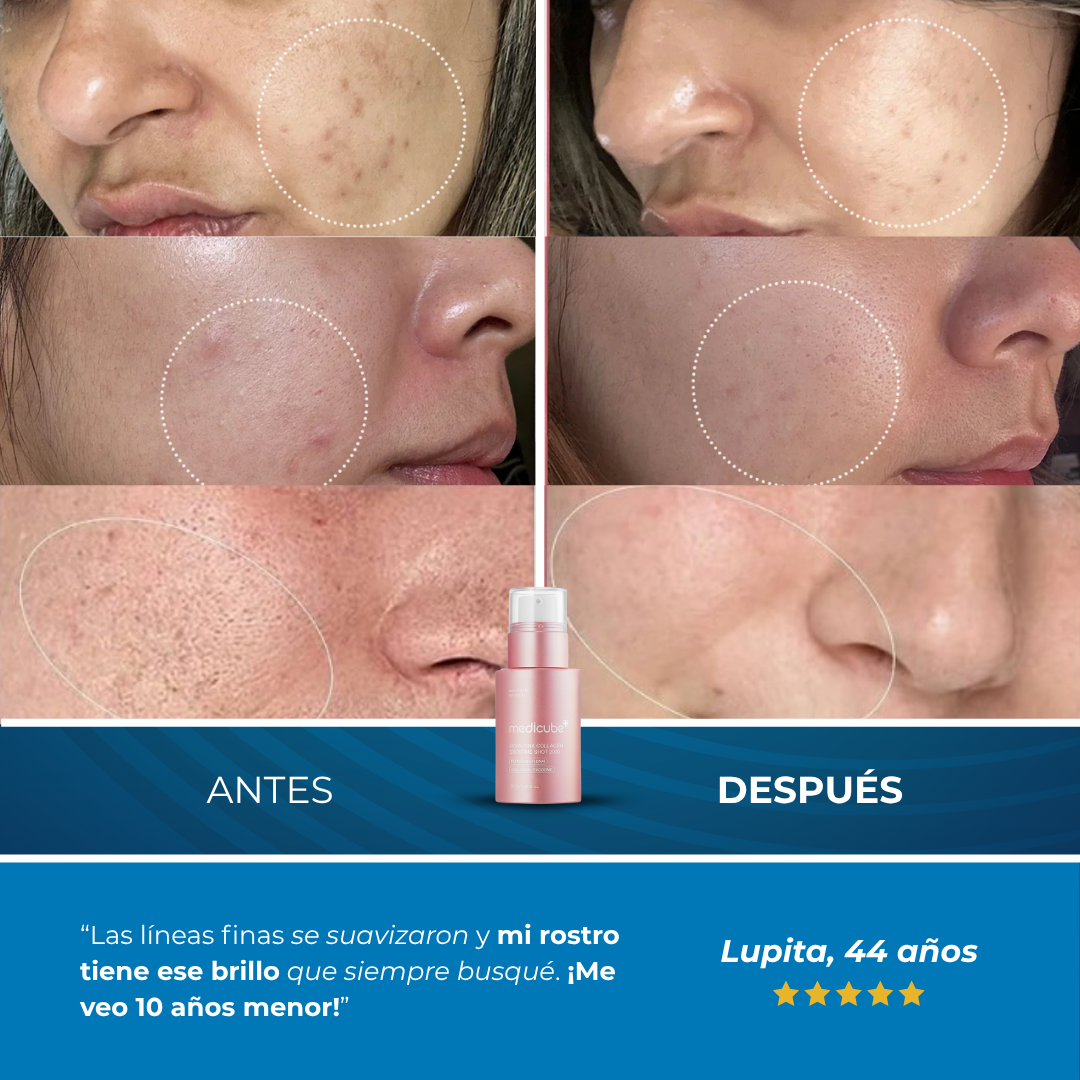 Sovana Exosome - Sérum Rejuvenecedor con Exosomas potenciadoras de colágeno