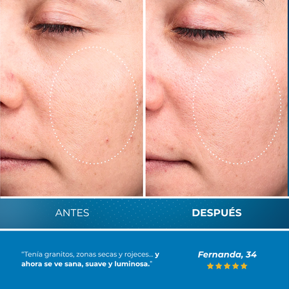 Sovana Iunik - Sérum para Pieles deshidratad y propensas al acné