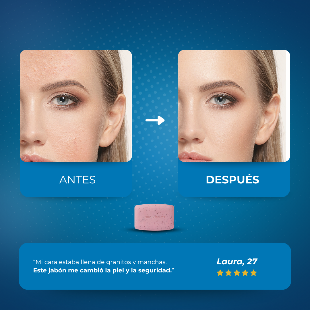 Sovana Revitalex - Jabón exfoliante con ácido salicílico anti-acné