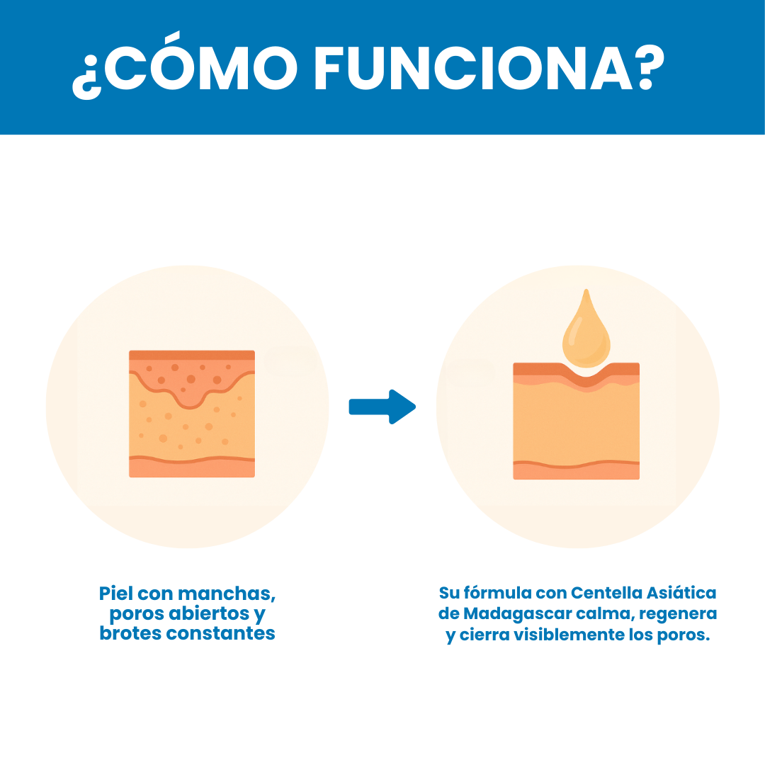 Sanorys Centella - Elimina manchas y puntos negros de tu rostro en sólo 6 días