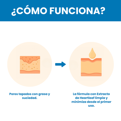 Sovana Anua - El único limpiador eficaz ante los puntos negros