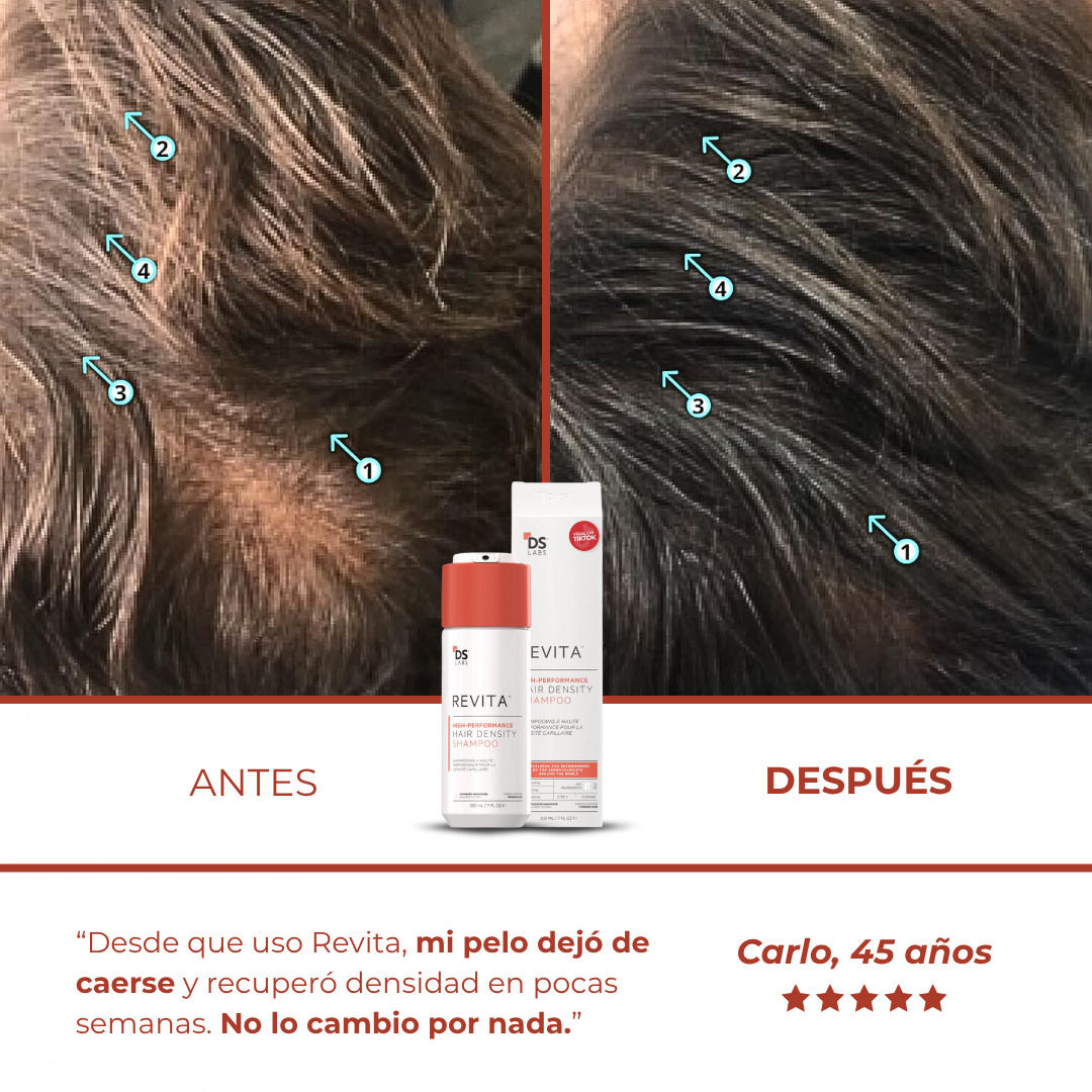 Revita™ - Champú Revitalizador de Densidad Capilar No Invasivo