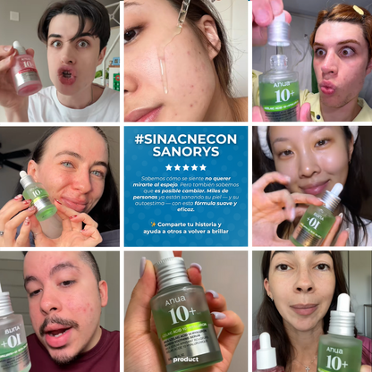 Sovana Anua - Sérum para eliminar tus manchas de acné en 6 días