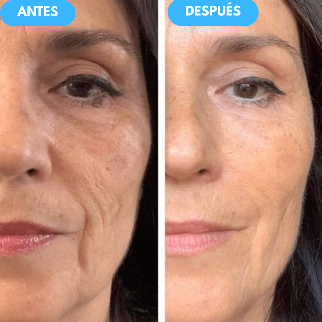 1+1 GRATIS| Nida™ - La solución definitiva para eliminar ojeras y bolsas del contorno de tus ojos