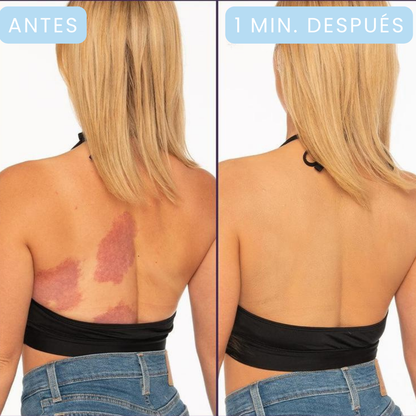 Westmore Beauty™ - El Maquillaje Corporal que Oculta Varices, Manchas y Cicatrices